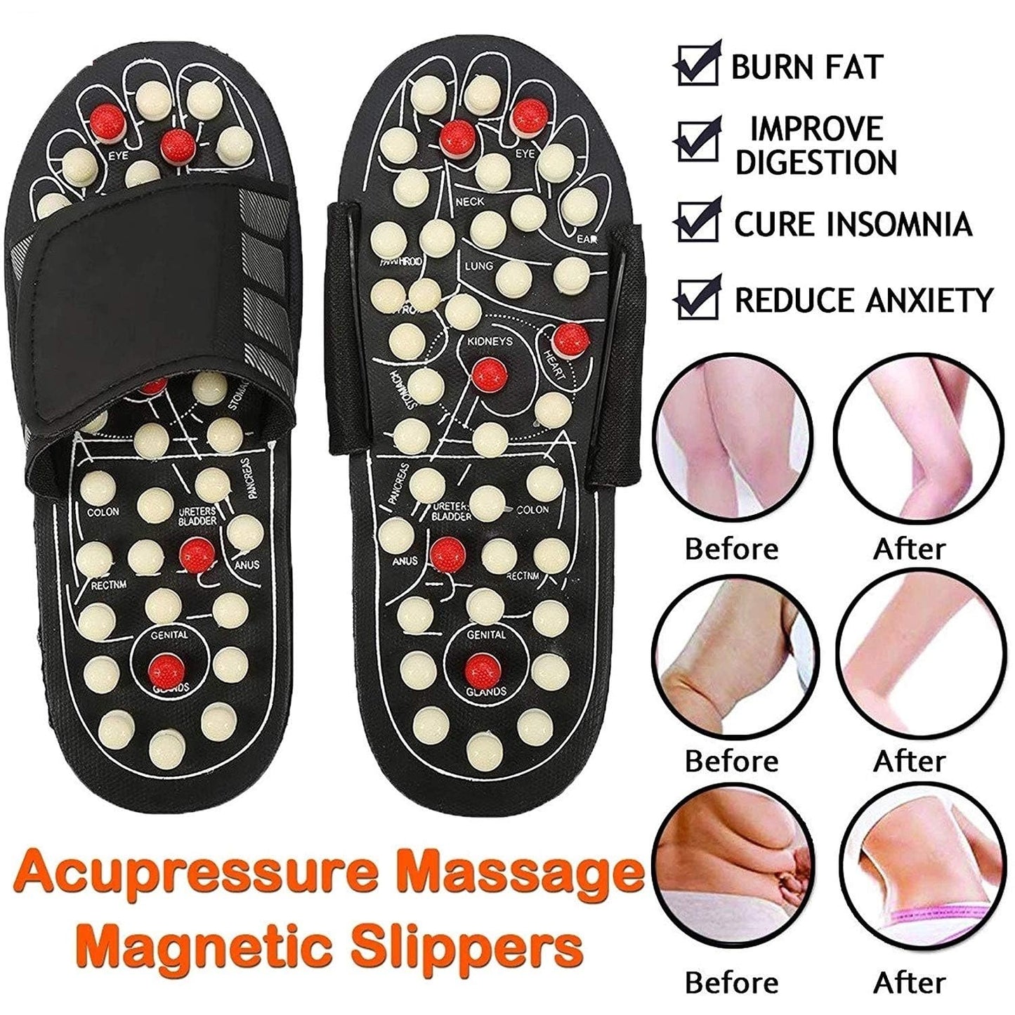 Roposo Clout acupressure and magnetic therapy slippers with cushioned soles, designed for foot massage and relief.